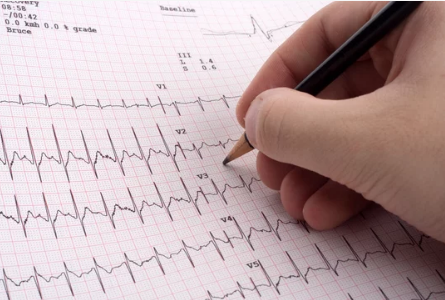 centro di cardiologia ambulatoriale