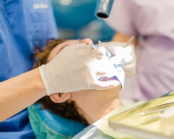 visita per pulizia dei denti
