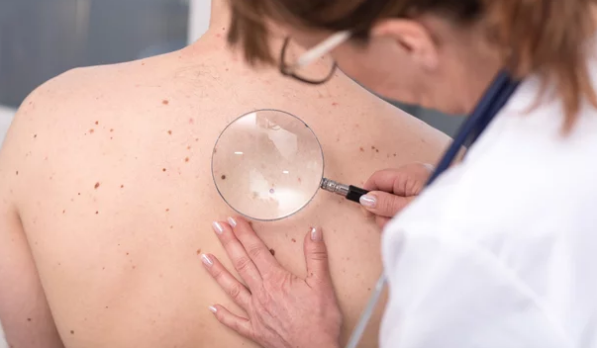 ambulatorio dermatologico
