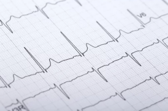 ecg