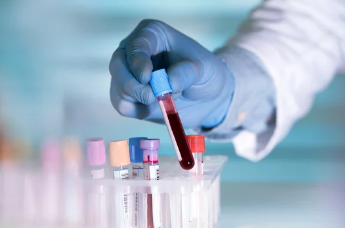 analisi del sangue