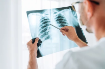 esame radiografico torace