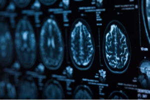 esame radiografico di neurologia