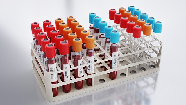 esami del sangue a domicilio