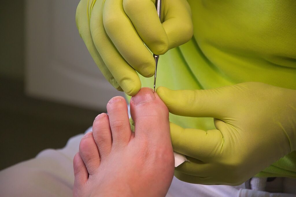 podologia clinica a domicilio