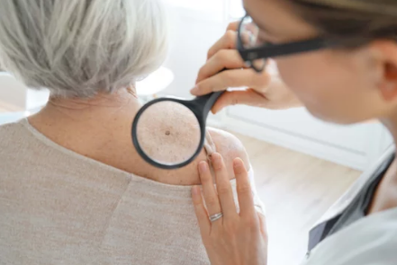 visita dermatologica domiciliare