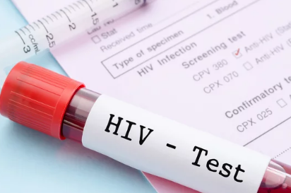 positivo hiv