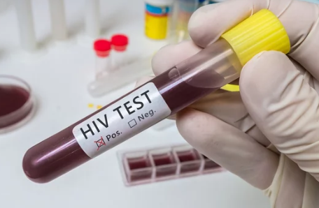 segnali hiv