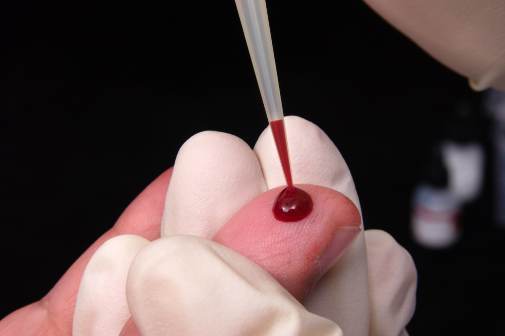 sieropositivo hiv