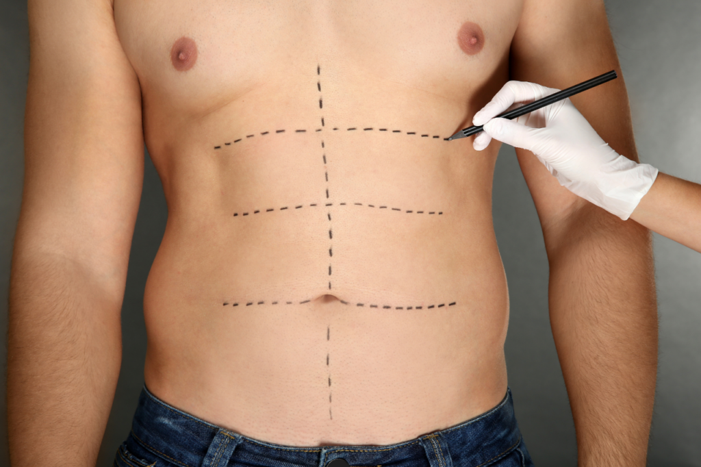 clinica dermoplastica