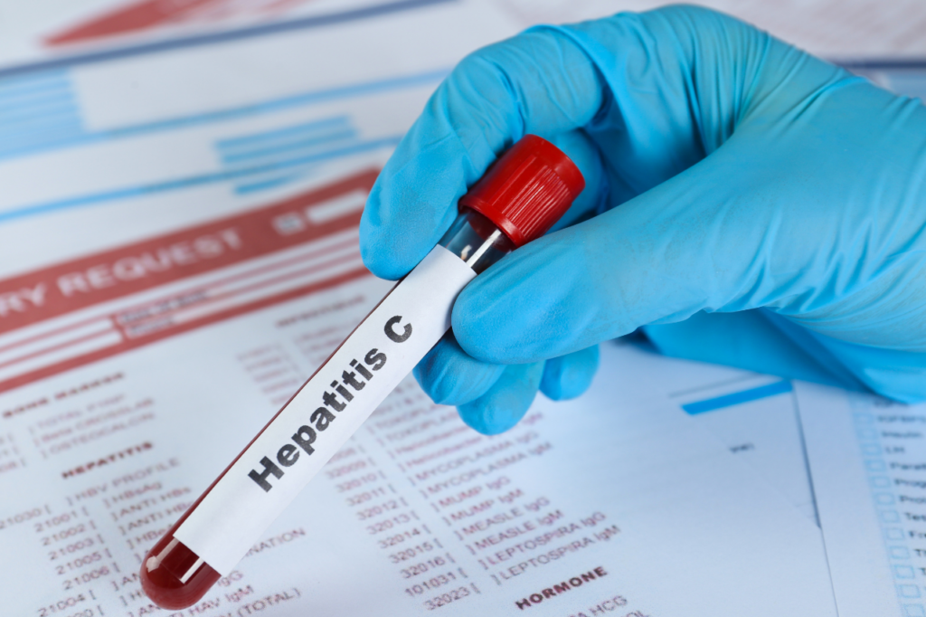 clinica epatologica