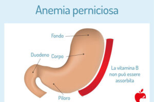 La Distrofia Gastrointestinale colpisce lo stomaco, una delle parti più importanti del nostro corpo