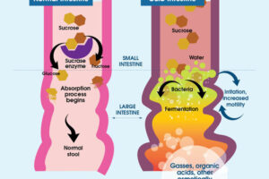 Confrontare il decorso della distrofia gastrointestinale di una persona con un diagramma tracciare un grafico per avere un quadro chiaro dei progressi