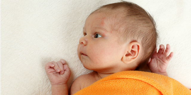 Ritratto di un bambino neonato con un dito sulla testa, mostrando la seria minaccia dellinfezione da parvovirus fetale La fotografia cattura un momento di preoccupazione e di speranza