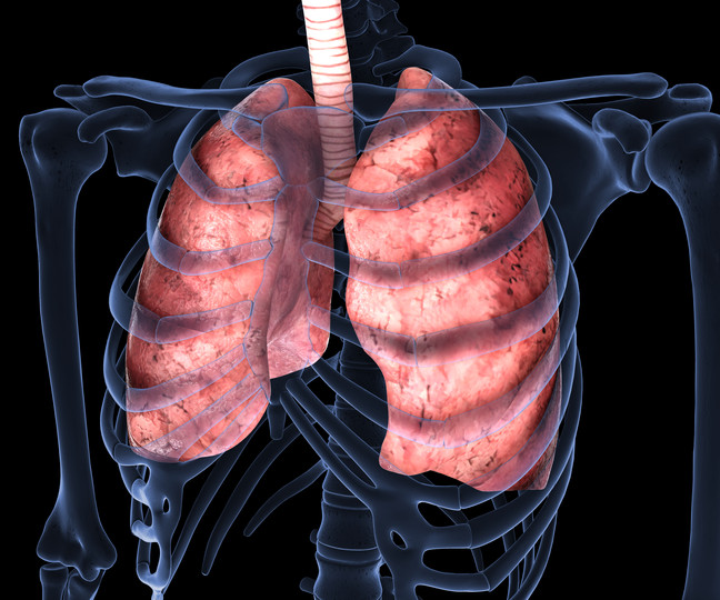 Unimmagine TAC di un paziente con una malattia polmonare ereditaria, mostrando una vista della parte del corpo intorno allo stomaco