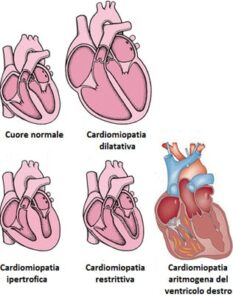 Prendersi cura del proprio cuore è importante Indossa labbigliamento e le calzature giuste, come sandali e infradito, per prevenire la malattia cardiaca congenita