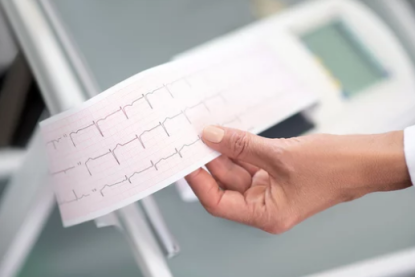 come fare un elettrocardiogramma cuore