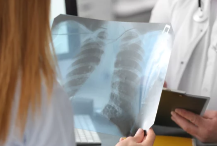 esami di radiografia polmonare