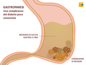 Uno stomaco con la distrofia gastrointestinale che galleggia allaperto nellacqua, circondato da un disco come se fosse parte di un corpo esterno