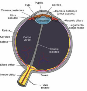 Questa immagine raffigura una malformazione oculare ereditaria rappresentata da una racchetta, che mostra la trama e il grafico degli effetti di questa patologia sulla vista