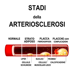 Un poster pubblicitario di prevenzione contro la malattia vascolare infantile che sottolinea limportanza della diagnosi precoce, mostrando unarma a forma di dinamite con il testo La diagnosi precoce è lunica arma contro la malattia vascolare infantile