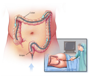 Una donna adulta con distrofia gastrointestinale guarda un monitor con un serpente, rappresentando la complessità del hardware del computer e dello stomaco