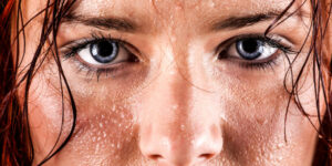 Una donna adulta con pelle asciutta, senza tracce di sudore, che rappresenta lassenza di sudorazione