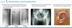 Una donna sposa adulta con calcificazione articolare arteriosa viene esaminata con una TAC per diagnosticare il problema Un gattino è seduto ai suoi piedi mentre viene eseguita la radiografia