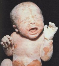 Un bambino di pochi giorni, con la pelle ancora delicata e squamosa, è la rappresentazione di una persona al suo esordio nella vita
