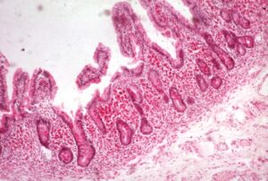 Labetalipoproteinemia è raffigurata in questa immagine, con una rosa paisley su una trama modello di batteri e tessuto come una carta da parati Una rappresentazione unica di una condizione unica