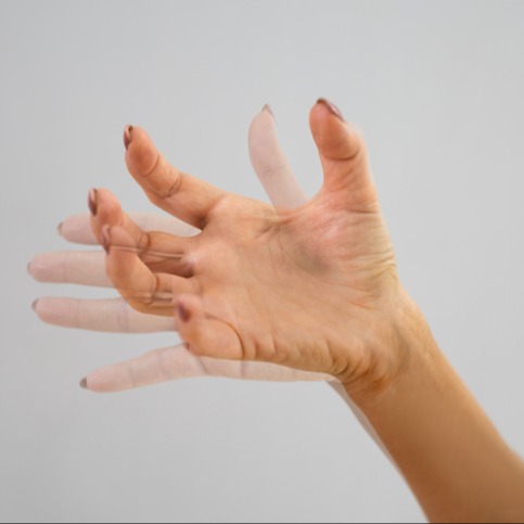 Una famiglia unita sostiene una persona con distonia adulto DYT Un dito sulla mano appoggiato al polso rappresenta lamore e laffetto di una famiglia