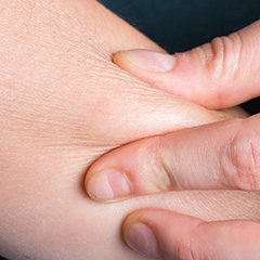 Il bambino sente un dolore lancinante a causa di una complessa malformazione congenita Il dito della sua mano è coperto da una pelle sensibile che viene massaggiata delicatamente per alleviare il dolore