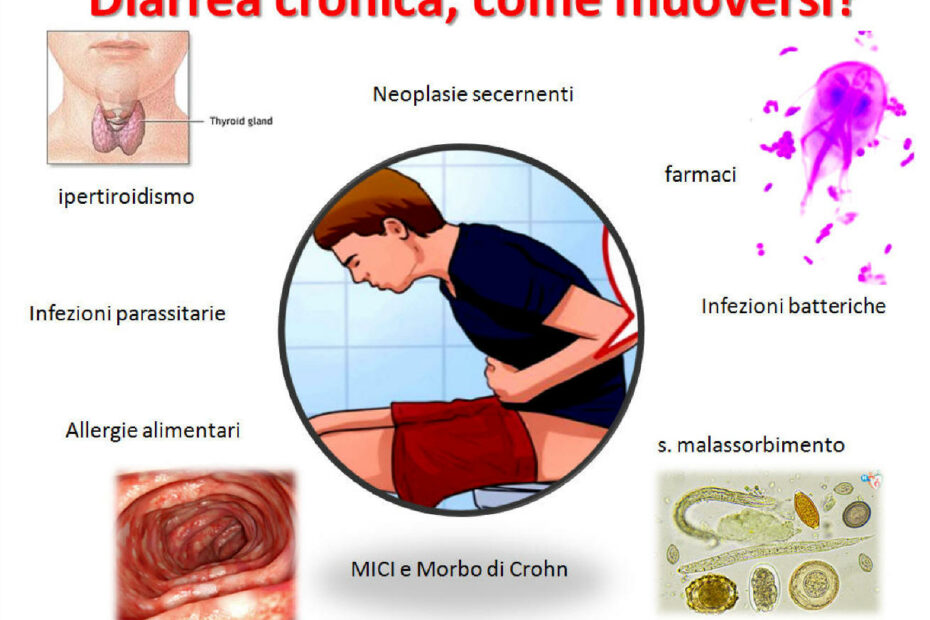 Sindrome di Diarrea Cronica associata alla Neuropatia Autonoma Hereditaria.