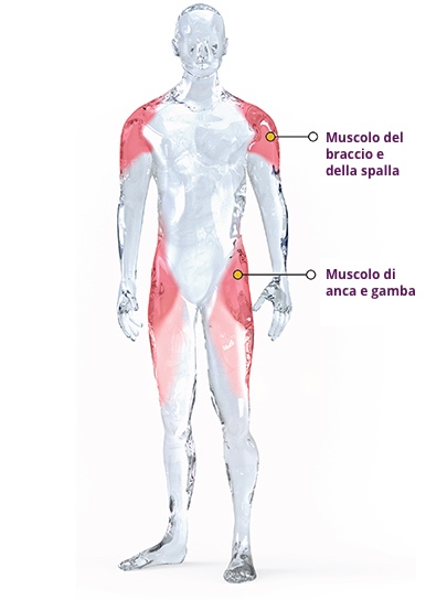 Distrofia Muscolare dei Cingoli di Tipo R23 Associata alla Subunita Alfa 2 della Laminina.
