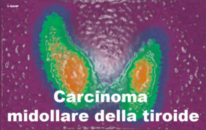 Unimmagine che unisce arte, natura ed acqua uno scorcio di mare allaperto, con lOceano Viola in primo piano, un simbolo di speranza contro il cancro alla tiroide Una terra che sfuma in una tavolozza di colori, mostrando la sua bellezza e potenza