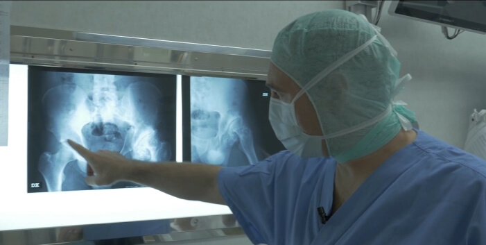 Uomo adulto in un ospedale che effettua una Tac per diagnosticare una malattia congenita un medico esperto osserva attentamente i dati sullo schermo del monitor