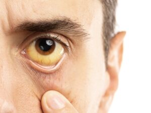 Un uomo adulto con lenti a contatto che proteggono gli occhi dalle malattie infettive una foto che ritrae il viso di una persona in primo piano