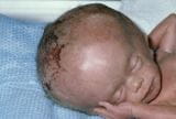 Un neonato sorridente con una testa di ratto unimmagine che ritrae lunione di due mondi molto diversi, quello dei mammiferi e quello dei roditori, rappresentando la realtà di un disturbo cranio cerebrale che coinvolge la testa e il viso di un bambino