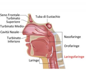 Questa immagine mostra una persona con unanomalia tracheale Si vede la parte posteriore del corpo, con il viso, la testa, il collo e la schiena ben visibili Si notano anche la gola e una linea che suggerisce la presenza di una trachea